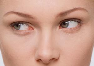 確実に気になる部分の痩身が叶う脂肪吸引